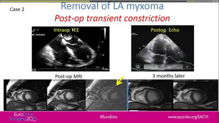Presentation thumbnail