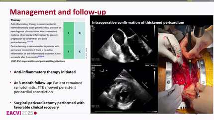 The role of multimodality imaging in freeing the captive heart