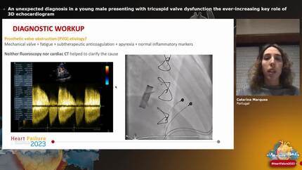 An unexpected diagnosis in a young male presenting with tricuspid valve dysfunction  the ever-increasing key role of 3D echocardiogram
