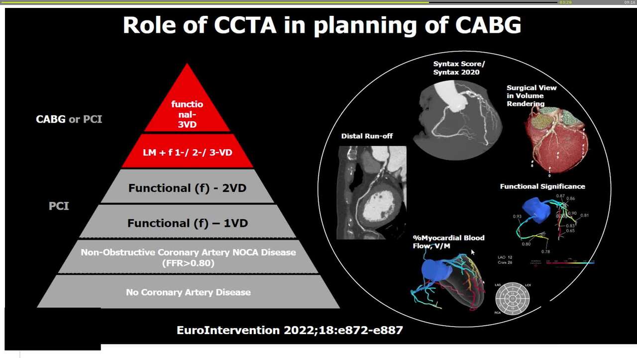 Advanced coronary computed tomography angiography (CCTA) in my daily practice
