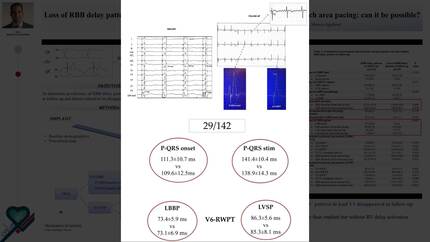 Loss of RBB delay pattern in lead V1 at follow-up and persistent left bundle branch area pacing: can it be possible?