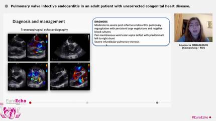Pulmonary valve infective endocarditis in an adult patient with uncorrected congenital heart disease.