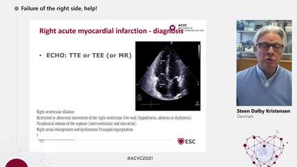 Presentation thumbnail