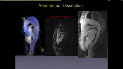 Presentation thumbnail