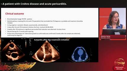 Presentation thumbnail