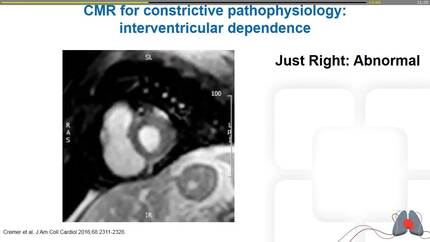 Presentation thumbnail