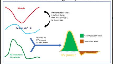 Right ventricular myocardial work in heart failure with preserved ejection fraction: insights from invasive cardiopulmonary exercise testing