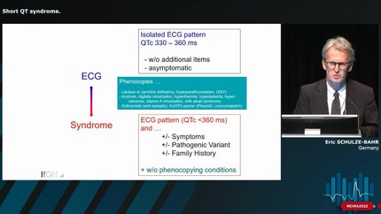 Short QT syndrome.
