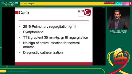 Pulmonary regurgitation and central pulmonary branch stenosis - Cardiologist