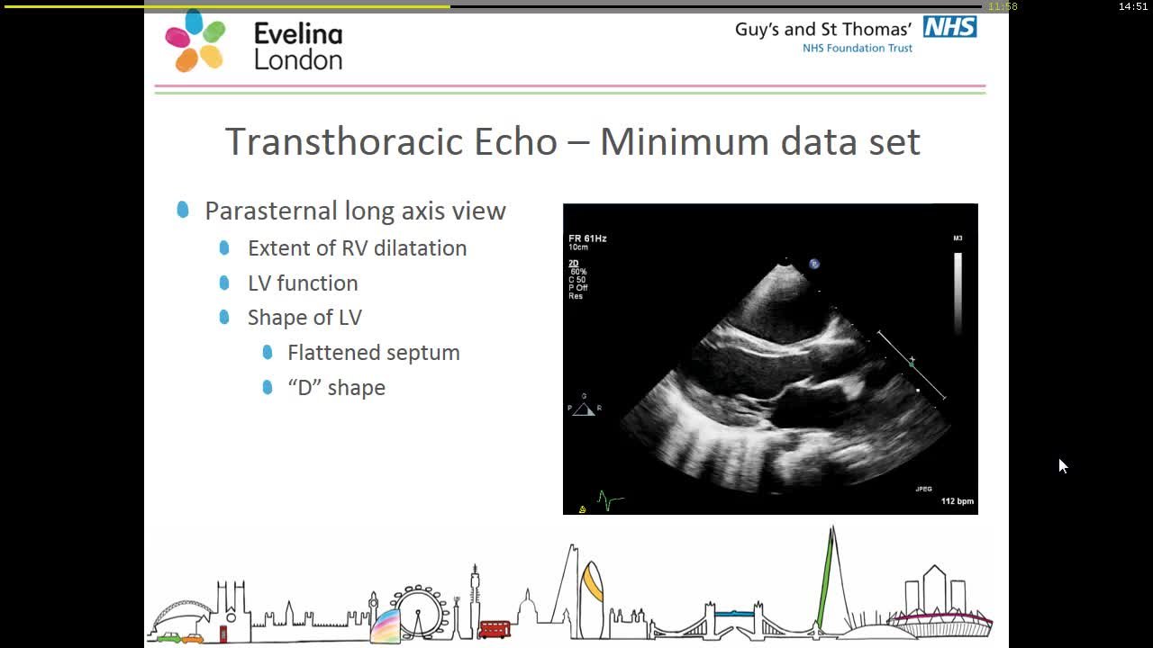 Presentation thumbnail