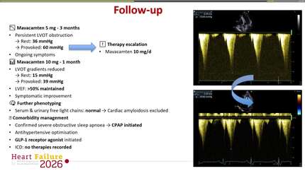 Obstruction-driven HFpEF in hypertrophic cardiomyopathy: a multimodal, guideline-based approach