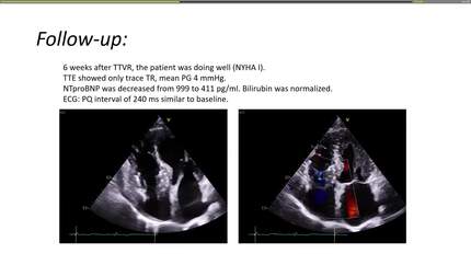 Presentation thumbnail
