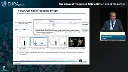 The dawn of the pulsed field ablation era in my center