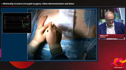 Transcatheter repair/replacement of the mitral and tricuspid valves: new devices, new techniques, and more