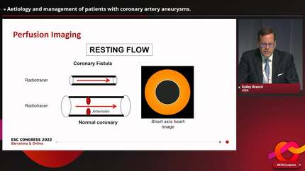 Aetiology and management of patients with coronary artery aneurysms.