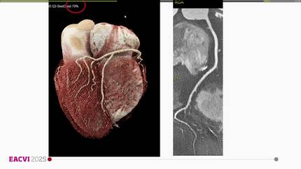 Blunders, bloopers, and better practice: lessons from imaging errors