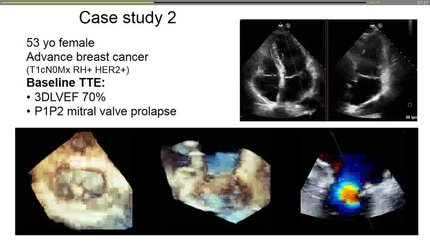 Presentation thumbnail