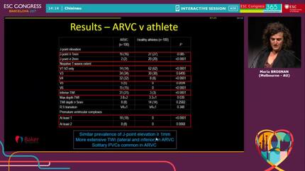 J-point elevation in subjects with TWI V1-V4 does not differentiate between arrhythmogenic right ventricular cardiomyopathy (ARVC) and healthy athletes when matched for age, sex and ethnicity.