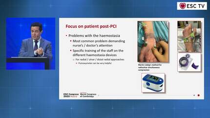 Made Easy Series - Revascularisation strategies