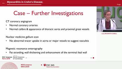Myocarditis in Crohn's Disease.