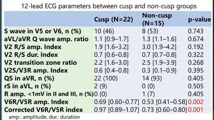 The V6R/V5R index, a novel ECG criterion, can identify idiopathic ventricular arrhythmias arising from the aortic cusp.