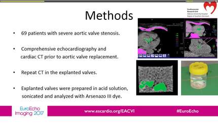 Aortic valve stenosis: correlation between aortic valve calcification by computed tomography and the amount of calcium in the valve