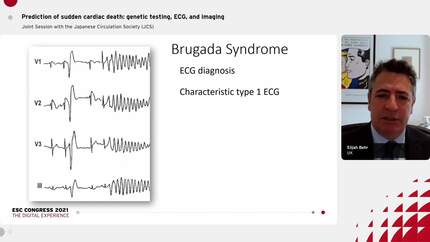 Prediction of sudden cardiac death: genetic testing, ECG, and imaging