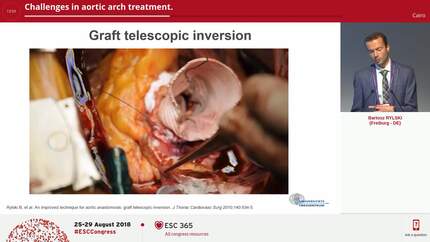 Challenges in aortic arch treatment.