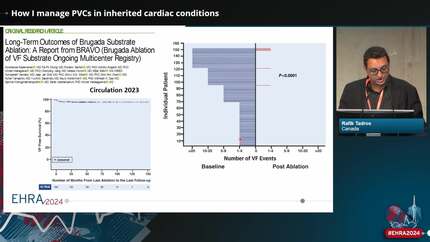 How I manage PVCs in inherited cardiac conditions