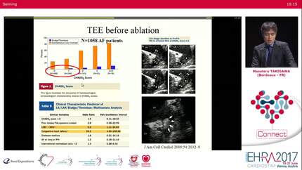 APHRS: our view on stroke prevention.