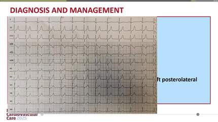 Presentation thumbnail