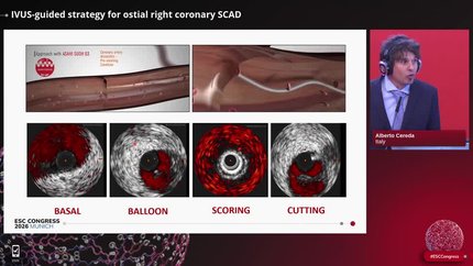 Illustrative cases of guideline-directed acute coronary syndromes management