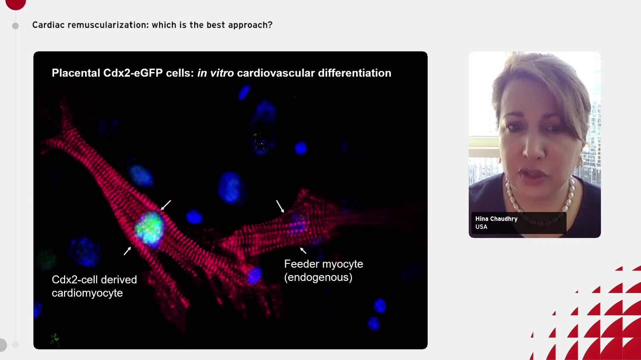 Cardiac remuscularization: which is the best approach?  