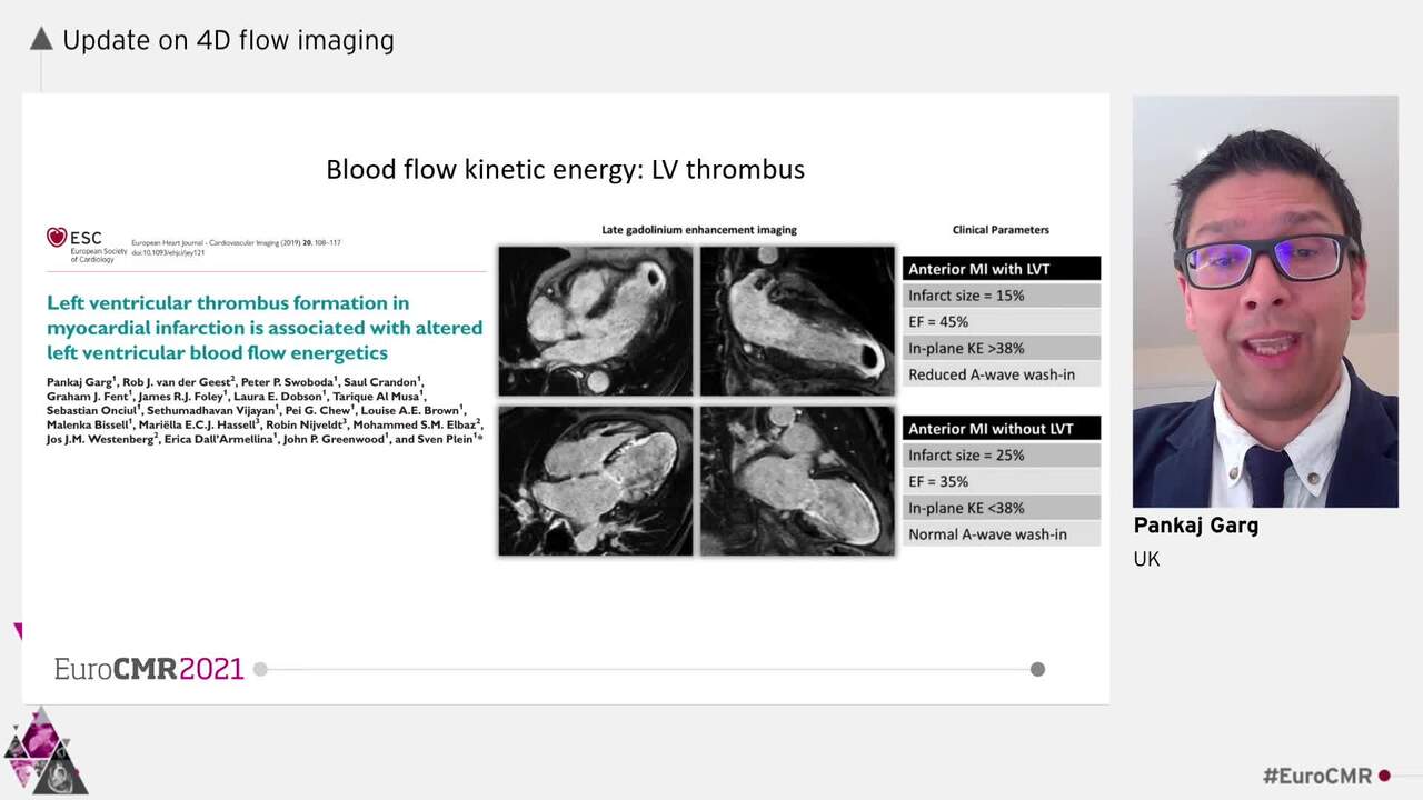 Update on 4D flow imaging