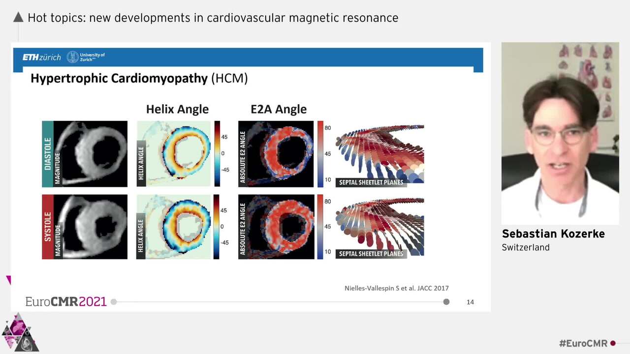 Diffusion tensor imaging and the sheetlets of the heart.