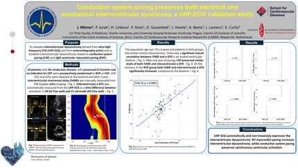 Conduction system pacing preserves both electrical and mechanical interventricular synchrony, a UHF ECG validation study