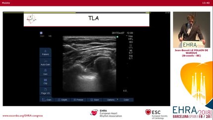 Presentation thumbnail