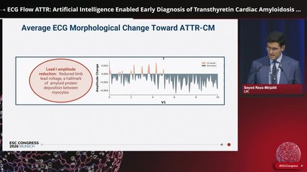 ECG Flow ATTR: Artificial Intelligence Enabled Early Diagnosis of Transthyretin Cardiac Amyloidosis Using Electrocardiography