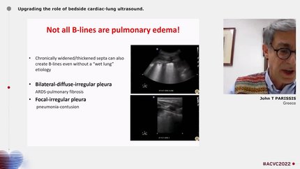 Emerging concepts to manage patients with acute heart failure in the Emergency Department 