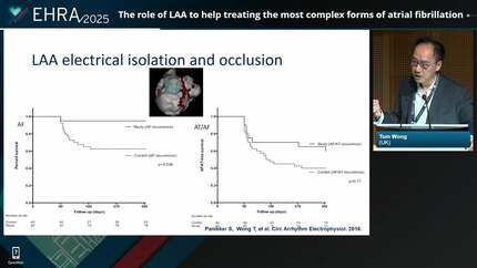 The role of LAA to help treating the most complex forms of atrial fibrillation