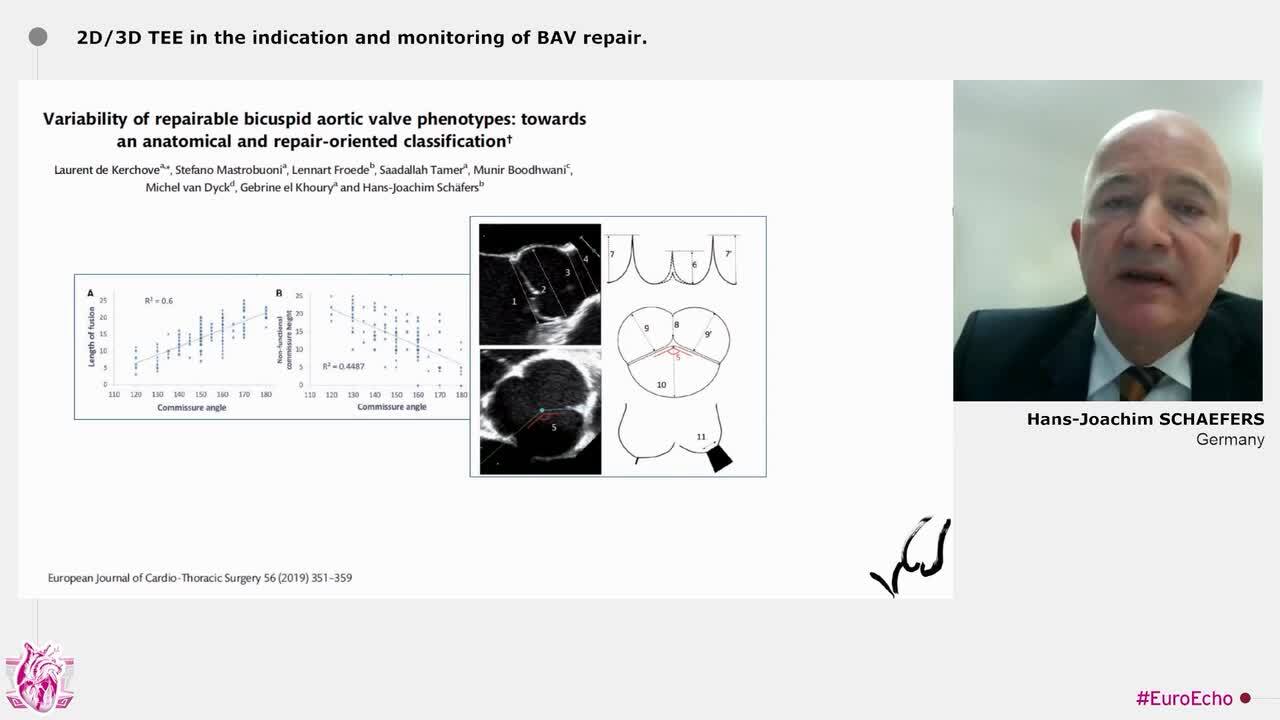 Advances in bicuspid aortic valve (BAV) imaging