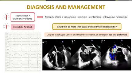 When infection spreads: an unusual case of shock at the intensive care unit