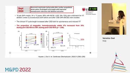 The role of cardiac sympathetic denervation in the management of arrhythmia