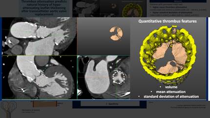 Presentation thumbnail