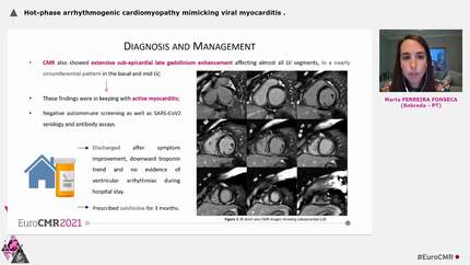 Hot-phase arrhythmogenic cardiomyopathy mimicking viral myocarditis
.