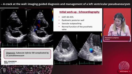 Complications of acute coronary syndromes and percutaneous coronary intervention: cases managed according to the guidelines