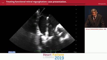 Treating functional mitral regurgitation: case presentation.