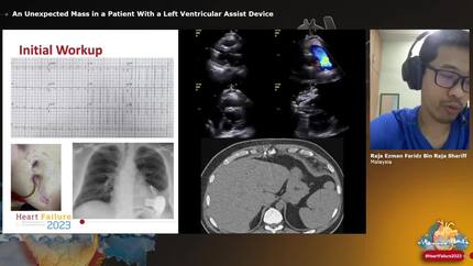 Presentation thumbnail