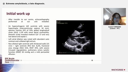 Extreme amyloidosis, a late diagnosis.