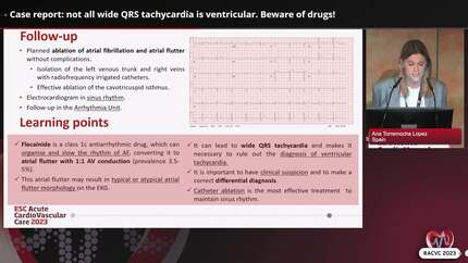 Case report: not all wide QRS tachycardia is ventricular. Beware of drugs!